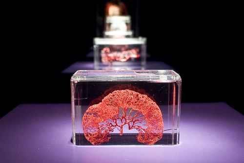 Read more about the article Ogromny sukces wystawy The Human Body Exhibition w Polsce!